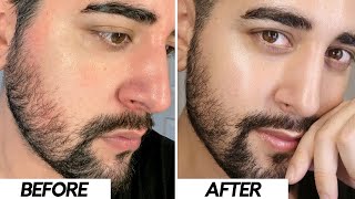 WHY I STOPPED USING HYALURONIC ACID  HA Free Skincare Routine ✖ James Welsh [upl. by Tullius]