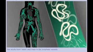 Lymphatic Filariasis Elephantiasis  Life Cycle [upl. by Nerrej145]