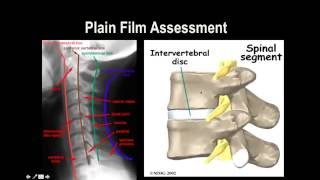 Cervical Spine XRay [upl. by Suoicerpal43]