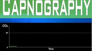 EtCO2 Capnography Part 2 [upl. by Georgiana39]