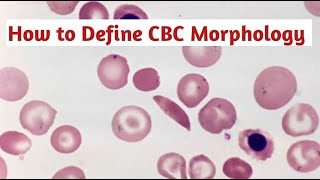 RBC morphology reporting [upl. by Lussi]