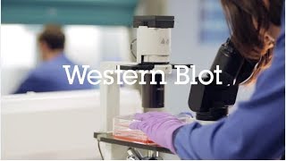 Western blot protocol video [upl. by Hcirteid]