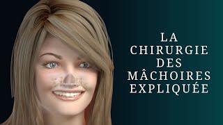 La chirurgie des mâchoires expliquée [upl. by Reldnahc]