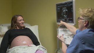 Ultrasounds during pregnancy [upl. by Nitsirk358]