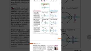 Göz kusurları AYT biyoloji [upl. by Gerg830]