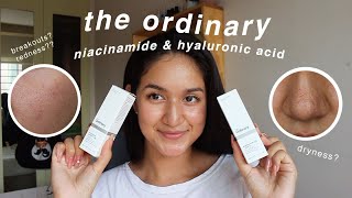 the ordinary niacinamide and hyaluronic acid 1 MONTH review with BEFOREAFTER [upl. by Machos]