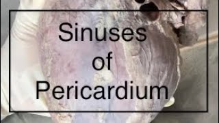 Sinuses of Pericardium Anatomy [upl. by Anuahs]