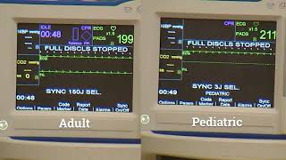 R Series Plus Synchronized Cardioversion [upl. by Grand]