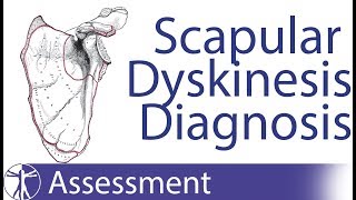 Diagnosing Scapula Dyskinesia [upl. by Emmaline]