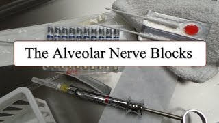 The Alveolar Nerve Blocks [upl. by Jolee]