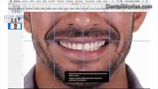 DSD  Digital Smile Design by Felipe Miguel [upl. by Elayor]