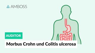 Morbus Crohn und Colitis ulcerosa  Worin unterscheiden sie sich  AMBOSS Auditor [upl. by Philips649]