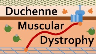 What to expect from Radiofrequency Denervation [upl. by Waddle18]