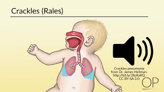 Respiratory Assessment by B Leary L DelSignore  OPENPediatrics [upl. by Atoiyanap]