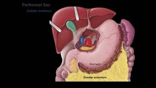 Peritoneum tutorial [upl. by Mansur]