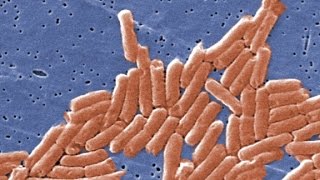 How do you prevent salmonella [upl. by Hnib]