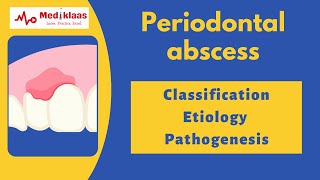 Periodontal Abscess Part 1  Classification etiology pathogenesis microbiology l Mediklaas [upl. by Farris934]