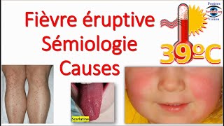 Fièvre éruptive Sémiologie Éruption erythemato maculo papuleuse vésiculeuse purpura Toxidermie [upl. by Mahalia]