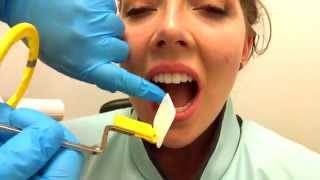 How to Take Periapical Radiographs [upl. by Colbye]