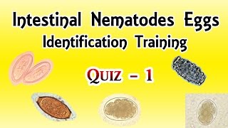 Intestinal Nematodes Eggs Identification Training Quiz 14 [upl. by Anilorak788]