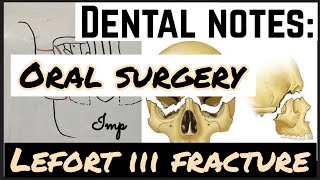 LEFORT III FRACTURE II MIDFACE FRACTURE II ORAL SURGERY [upl. by Balfore6]