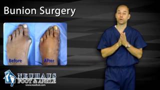 What To Expect After Bunion Surgery [upl. by Strade]