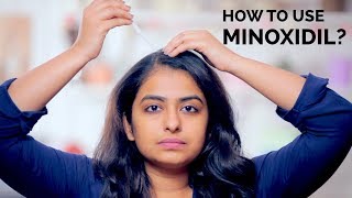 How To Use Minoxidil  Hair Regrowth  Skin Diaries [upl. by Airalednac]