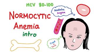 Normocytic Anemia Intro [upl. by Cleland]