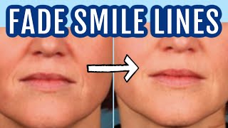 12 ways to fade smile lines nasolabial folds Dr Dray [upl. by Darraj]