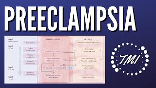 Preeclampsia Explicada Claramente [upl. by Kirred]