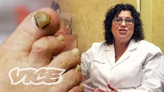 Meet a Toenail Fungus Expert [upl. by Elatnahc]