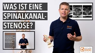 Spinalkanalstenose  Teil 1 Von der Ursache bis zur Erkrankung  Rollator früh verhindern [upl. by Nodnar]