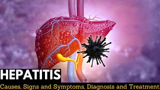 Hepatitis A B C D E Nursing Symptoms Treatment Causes NCLEX [upl. by Ecidnak]