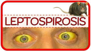 LEPTOSPIROSIS – fisiopatología microbiología signos y síntomas diagnóstico y tratamiento [upl. by Ylellan]