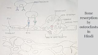 What You Need to Know About Metastatic Bone Disease with Dr Amalia De Comas  The CORE Institute [upl. by Boeschen445]