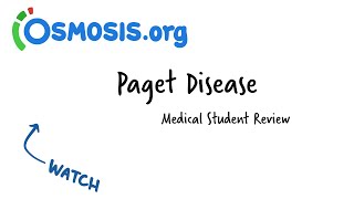 Paget Disease Osmosis Study Video [upl. by Timothea]