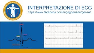 Interpretazione di ECG leggiamo insieme qualche elettrocardiogramma [upl. by Eletnahc66]