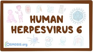 Human herpesvirus 6 Roseola  an Osmosis Preview [upl. by Corny]