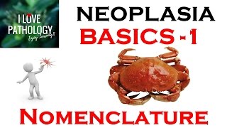 2 Neoplasia part 2 Differences between benign and malignant neoplasms [upl. by Parke]