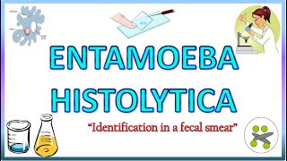 Entamoeba Histolytica  Morphology of the Trophozoite amp Cyst on Light Microscope Stools for AOC [upl. by Nolie]