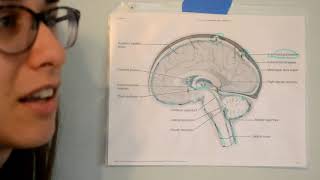 The Vertiflex Procedure What You Should Know [upl. by Werd]