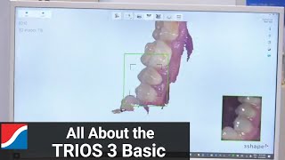 3Shape TRIOS 3 Basic Features and Benefits [upl. by Ahsinel]