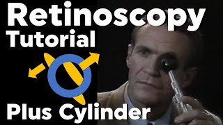 Retinoscopy Plus Cylinder Full Tutorial with Phoropter [upl. by Nalad721]