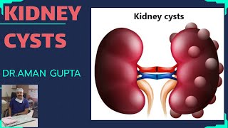 Bosniak Classification for Renal Cystic Disease [upl. by Ezequiel437]