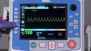 X Series® Advanced Cardioversion English [upl. by Gherardi]