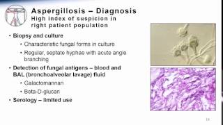 Aspergillosis [upl. by Kosey]