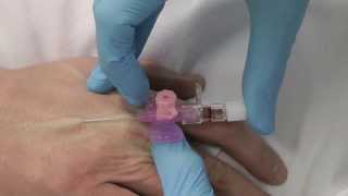 Cannulation How to gain IV access [upl. by Paris]