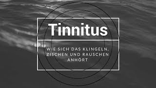 Wie hört sich ein Tinnitus an [upl. by Adena]