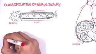 Neurology  Nerve Damage and Regeneration [upl. by Id]