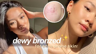 My Quick Natural Glow Makeup acneprone skin dark acne scars  Colleen Ho [upl. by Cuhp639]